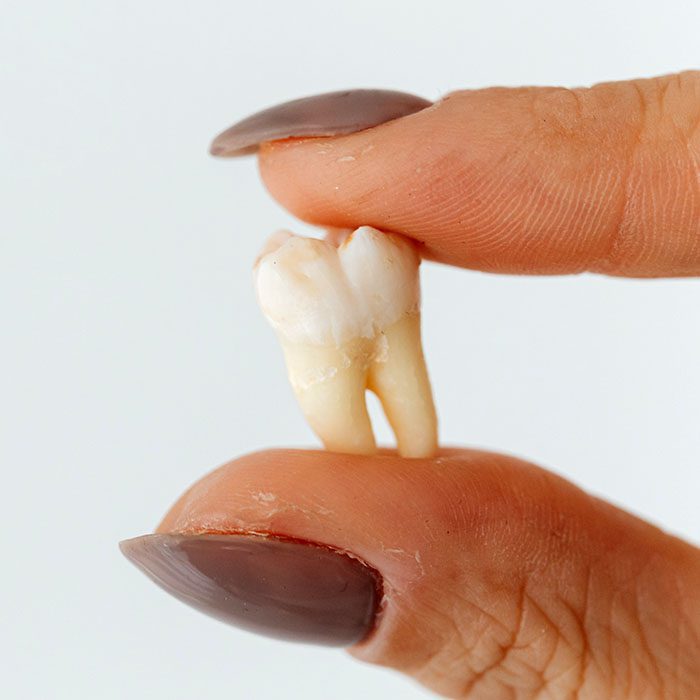 - Roberts Wellness Dental - Centralia Dentist