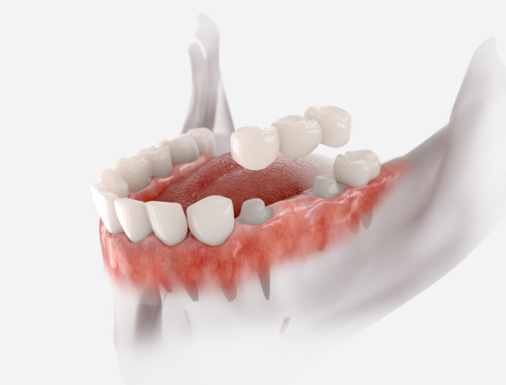 - Roberts Wellness Dental - Centralia Dentist