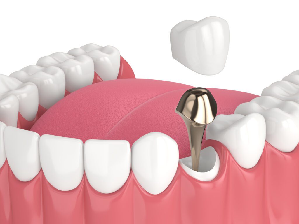 - Roberts Wellness Dental - Centralia Dentist