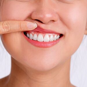 - Roberts Wellness Dental - Centralia Dentist