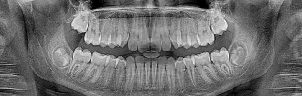 - Roberts Wellness Dental - Centralia Dentist